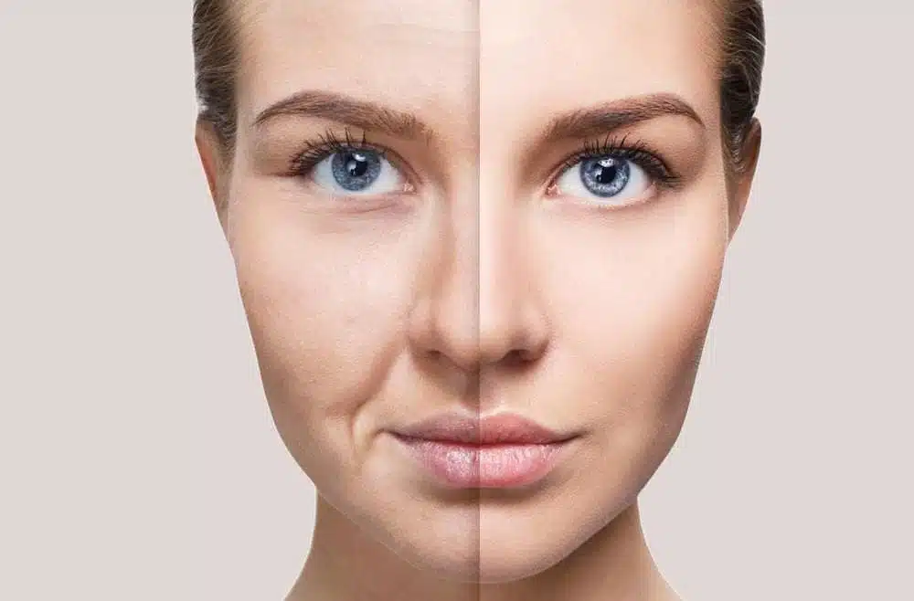 SkinGold antes e depois